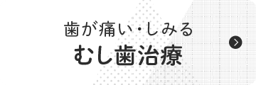 むし歯治療