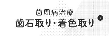 歯石取り・着色取り