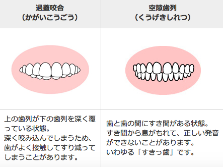 歯 変 な ところ から 生える